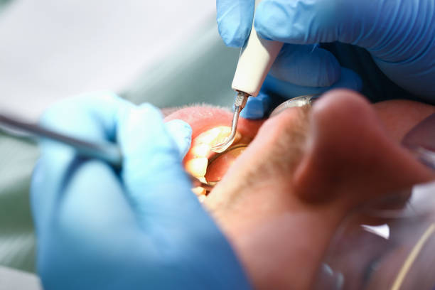 Best Weekend Emergency Dentist in Chelsea, MA